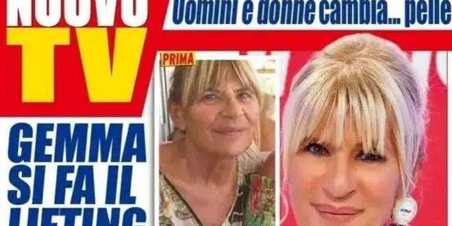 Uomini E Donne News Ecco Chi Ha Pagato Il Lifting Di Gemma Galgani