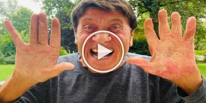 Video Gianni Morandi La Prima Volta Senza Le Bende Alle Mani