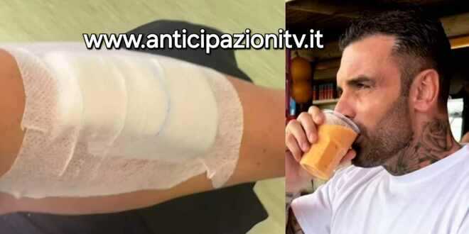 News Uomini e Donne, Mario Cusitore finisce in ospedale: le sue prime parole dopo l’intervento